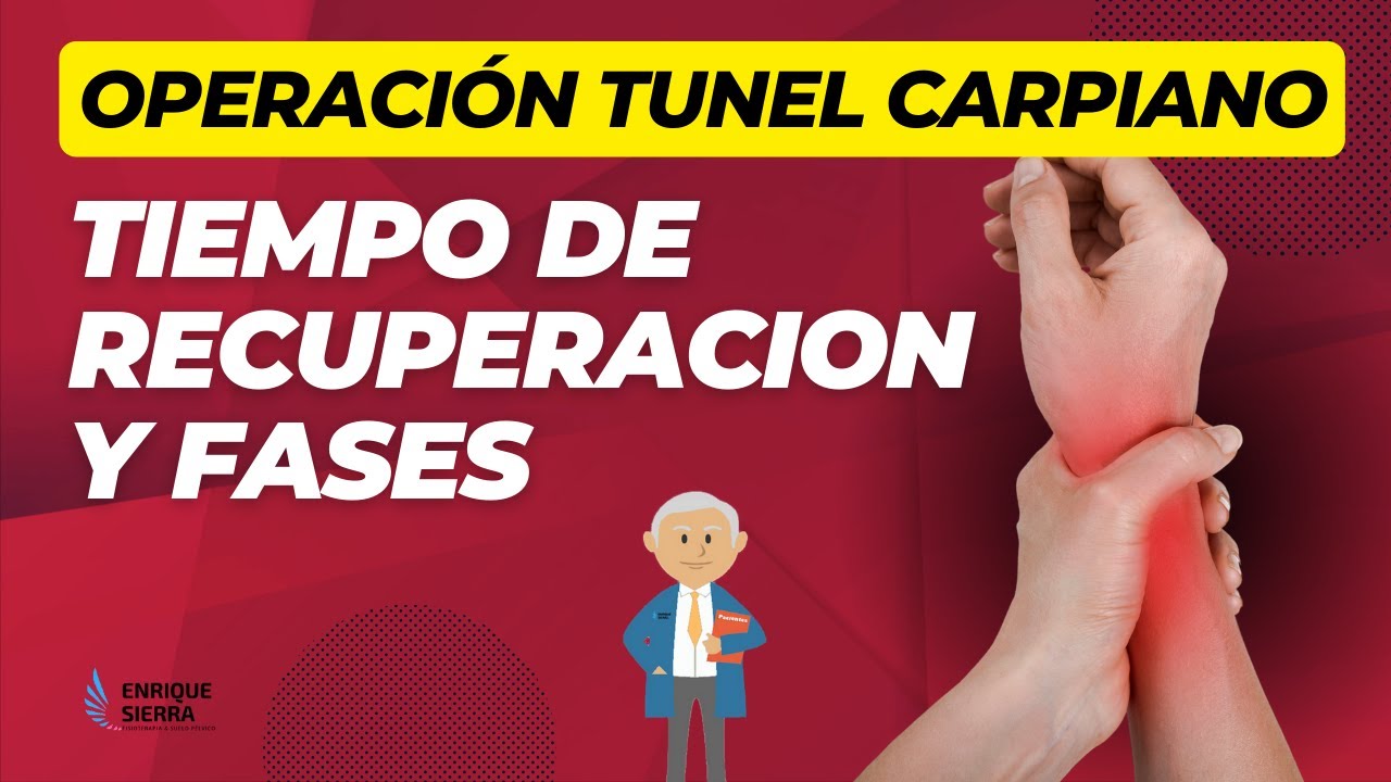 cuando se puede conducir despues de operarse del tunel carpiano